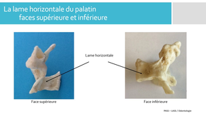 L - Palatin