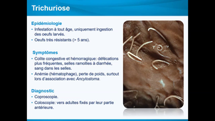 Enregistrement Etudes cliniques des ankylostomoses - Mr BEUGNET