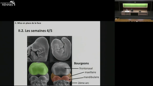 Odonto-Embryogenèse : Mise en place de la face et de la cavité buccale