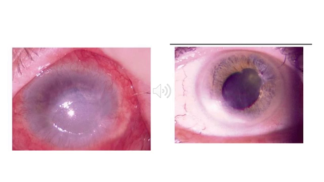 Médiathèque Pédagogique Maladies Infectieuses